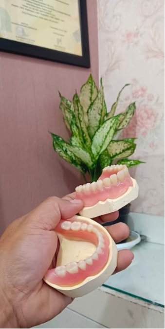 Hasil kerja JOE DENTAL — gigi palsu lepasan buatan tukang gigi Bandung (foto 8)