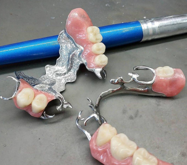 Hasil kerja JOE DENTAL — gigi palsu lepasan buatan tukang gigi Bandung (foto 7)